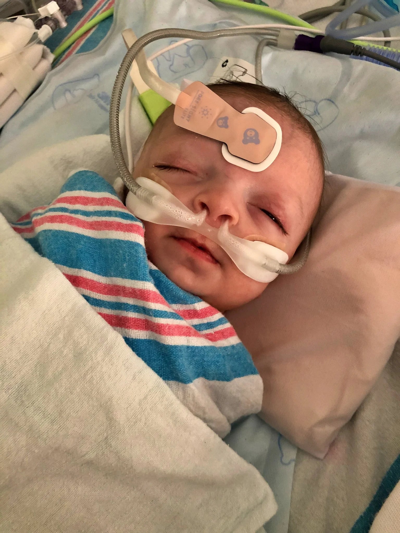 Newborn baby in a hospital setting with medical equipment and bandages.